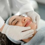 Treatment of facial stains with chemical peeling