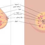 Exercise to shrink chest at home