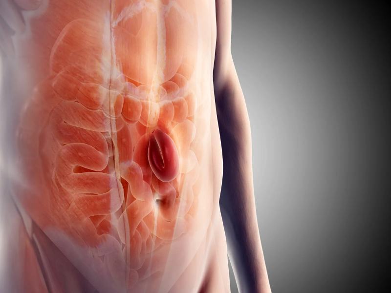 Symptoms of right abdominal hernia