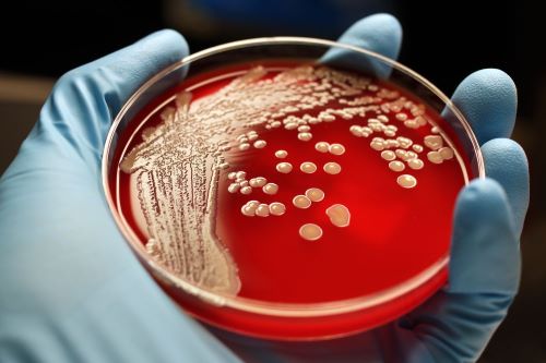 What to eat for body infection