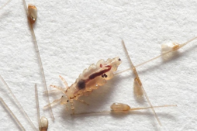 How is the lice egg?
