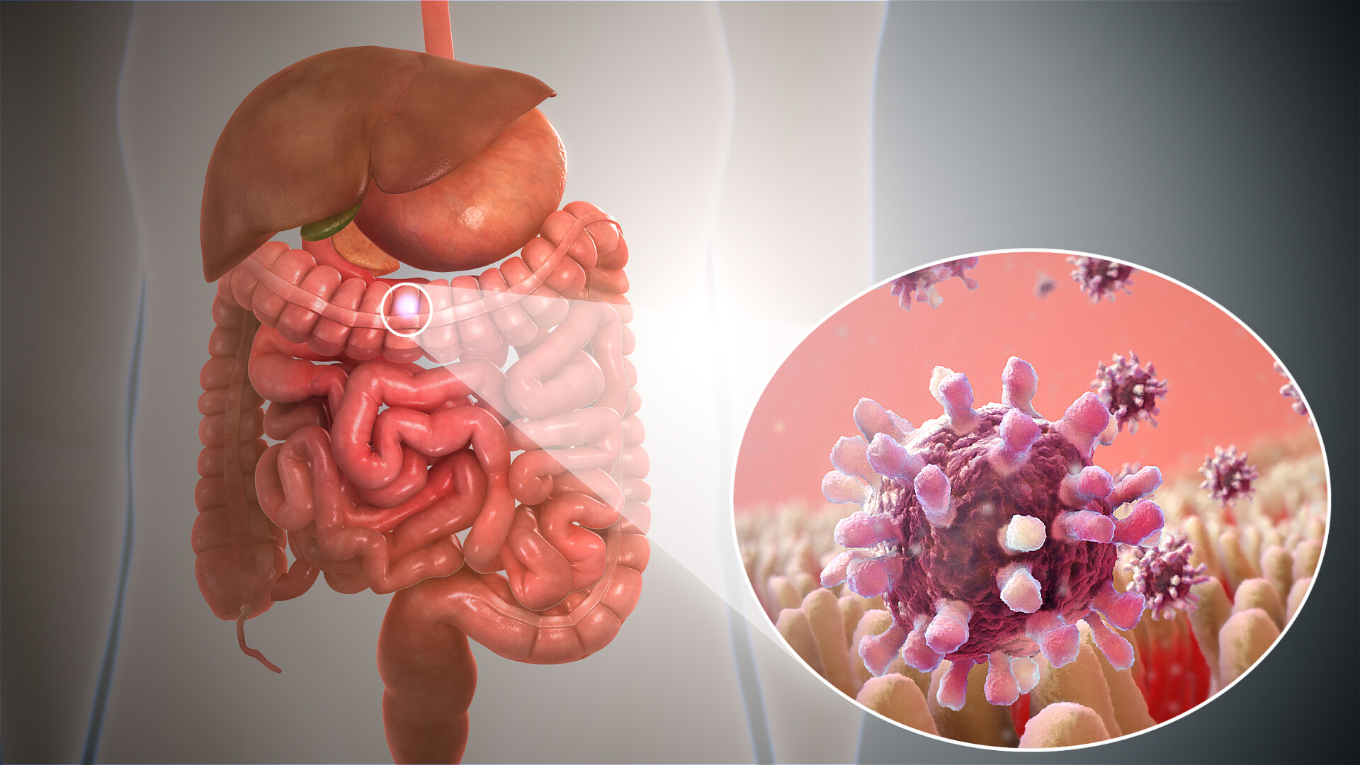 What are the symptoms of gastroiestinal virus?