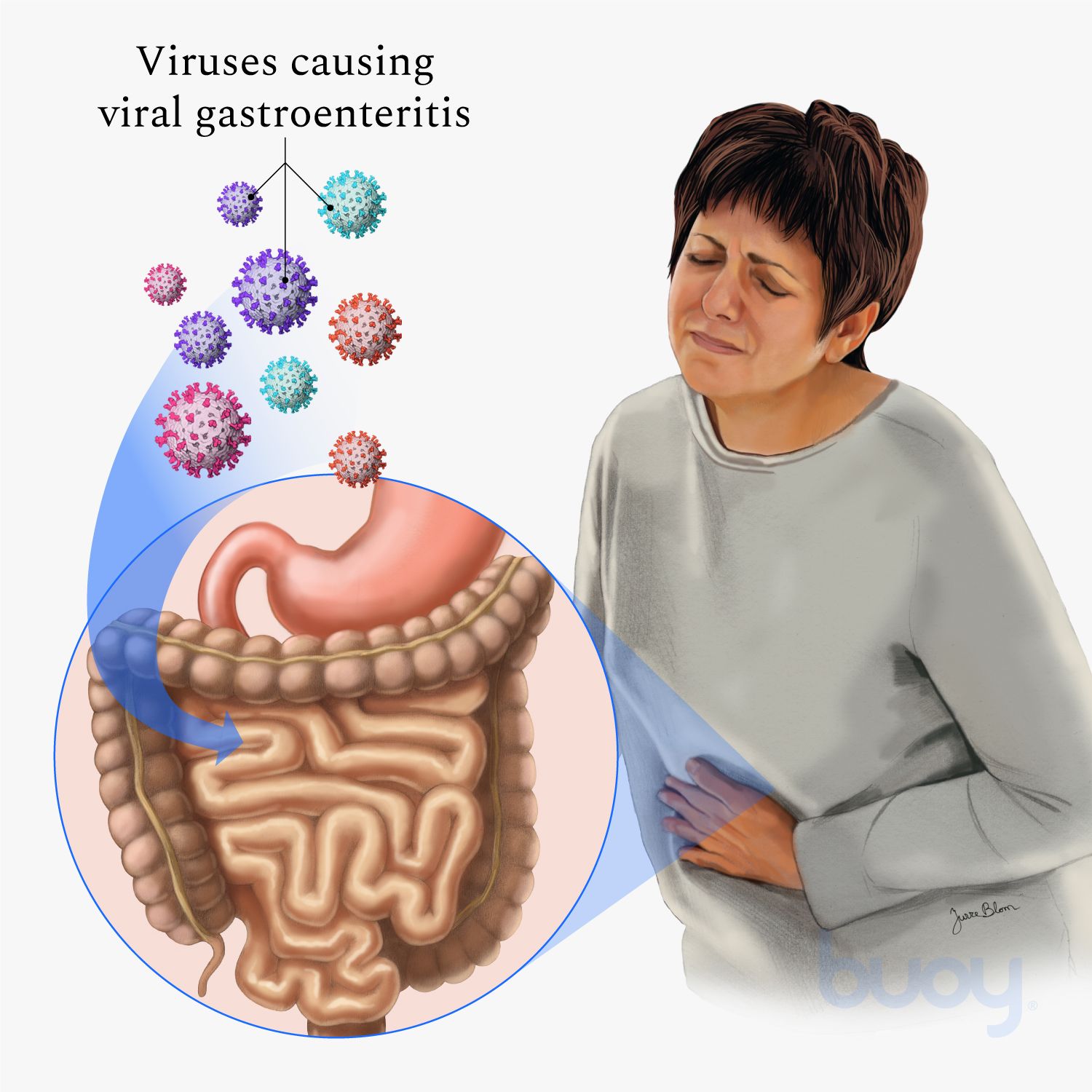 Home treatme of gastroiestinal viruses