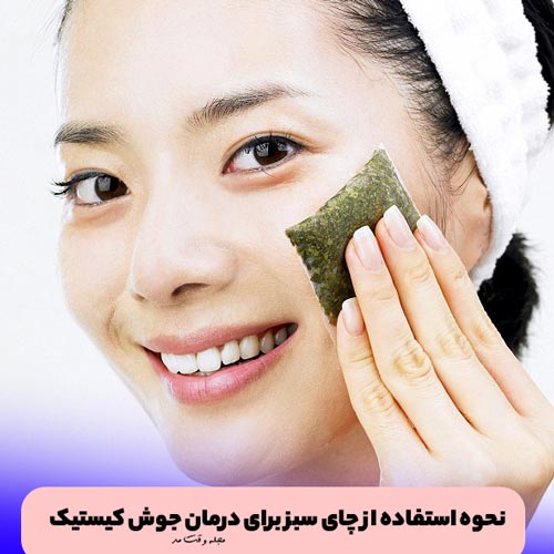 Green tea and green tea suitable for the treatme of facial subcutaneous pimples