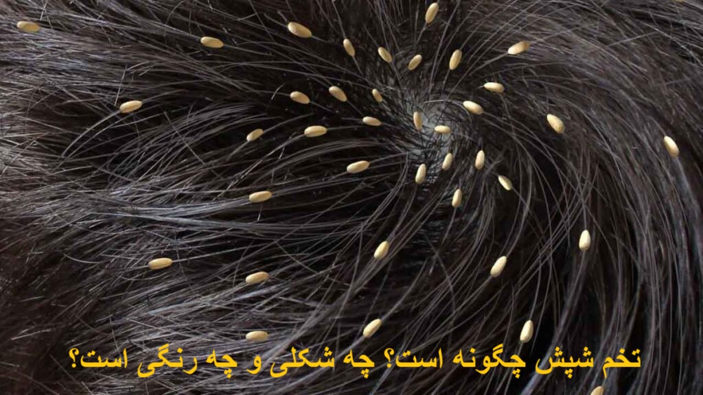 How is the lice egg? What kind and color is it?