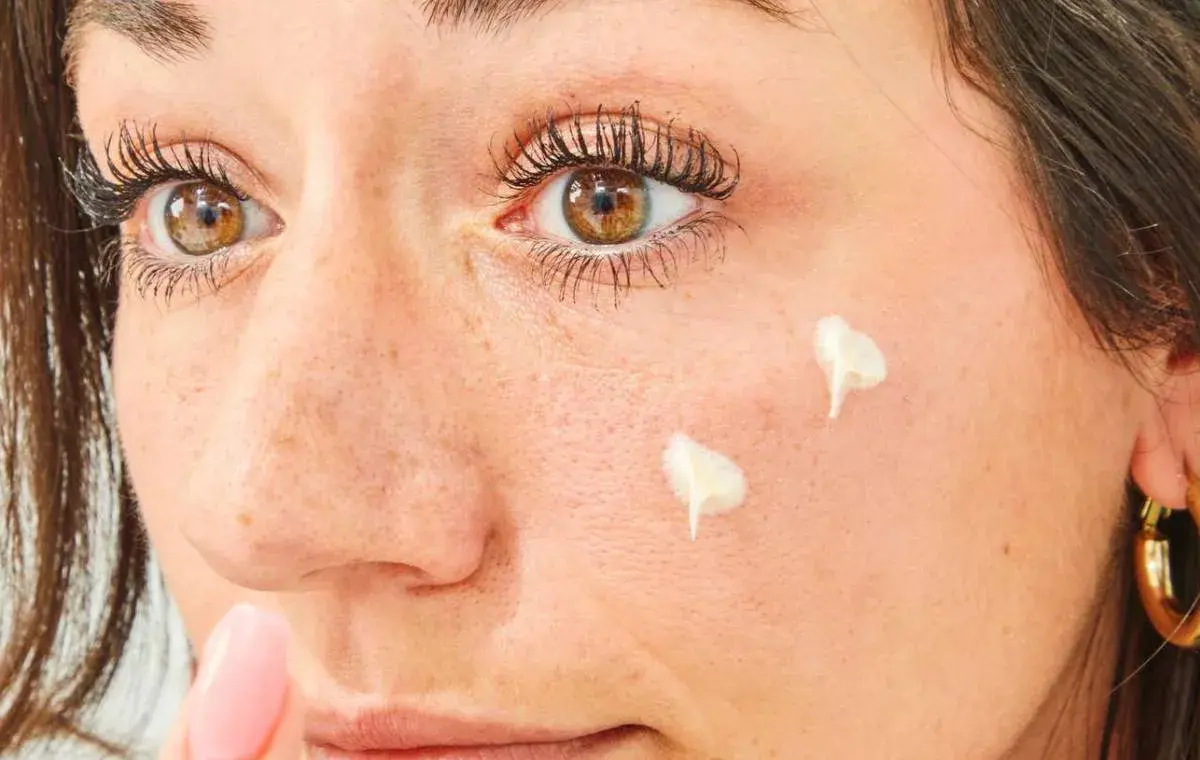 Complications of hydrocortisone oime for facial stains
