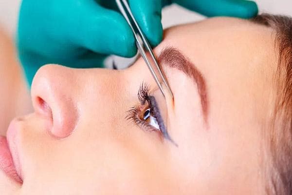 Shelf life of blepharoplasty