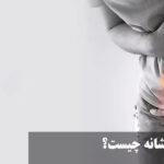 What is a sign of urine burning?
