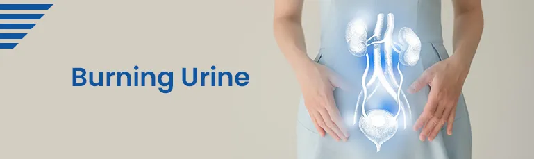 Cause of burning after urinating in men