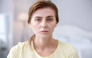 What vitamin deficiency causes yellowing of the skin?