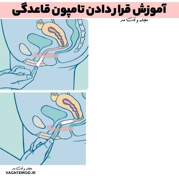 Teaching how to insert a menstrual tampon in the fashion health magazine.