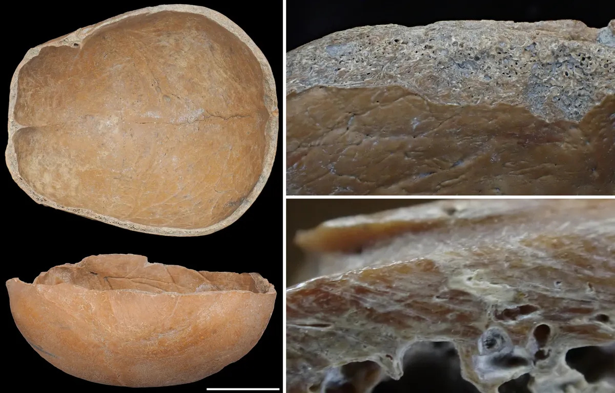 stone age
