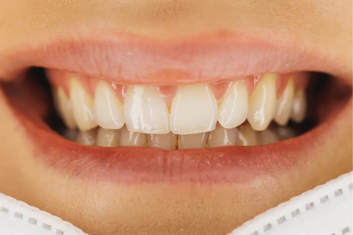 Why don't teeth cou as bones1 Why are teeth not considered bones? - Diginoy
