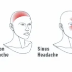 Your pillow is destroying your neck: