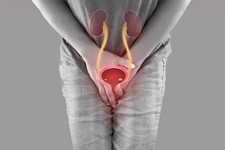 Home remedies for bladder infection in men