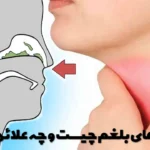What are the symptoms of phlegm and what are its symptoms?