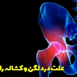 The cause of hip and groin pain in women