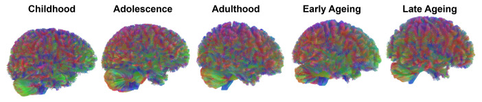 1000014115 Your Brain Changes at 9, 32, 66, and 83 - Diginoy