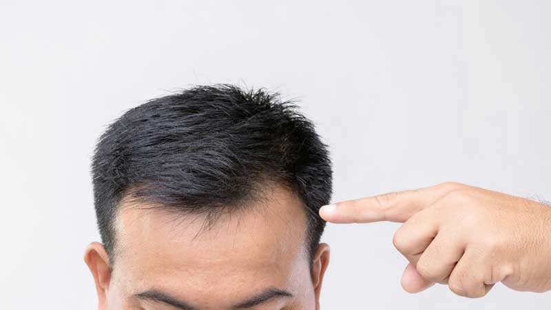 The best hair transpla clinic in Shiraz