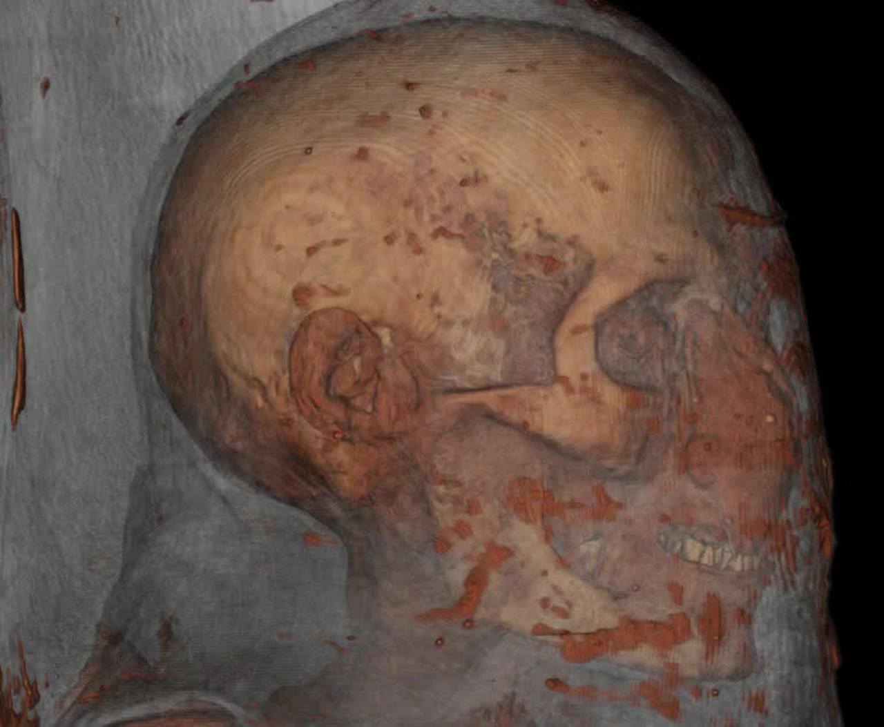 Scieists scanned two mummies and came up with some ieresting results - diginoy