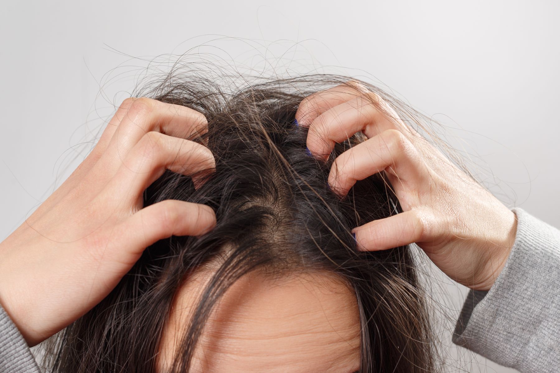 Itchy scalp after bathing