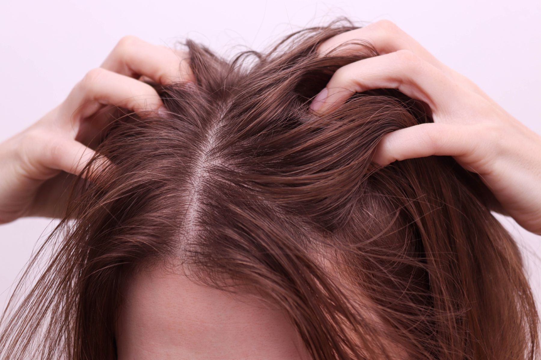 Itchy scalp after bathing