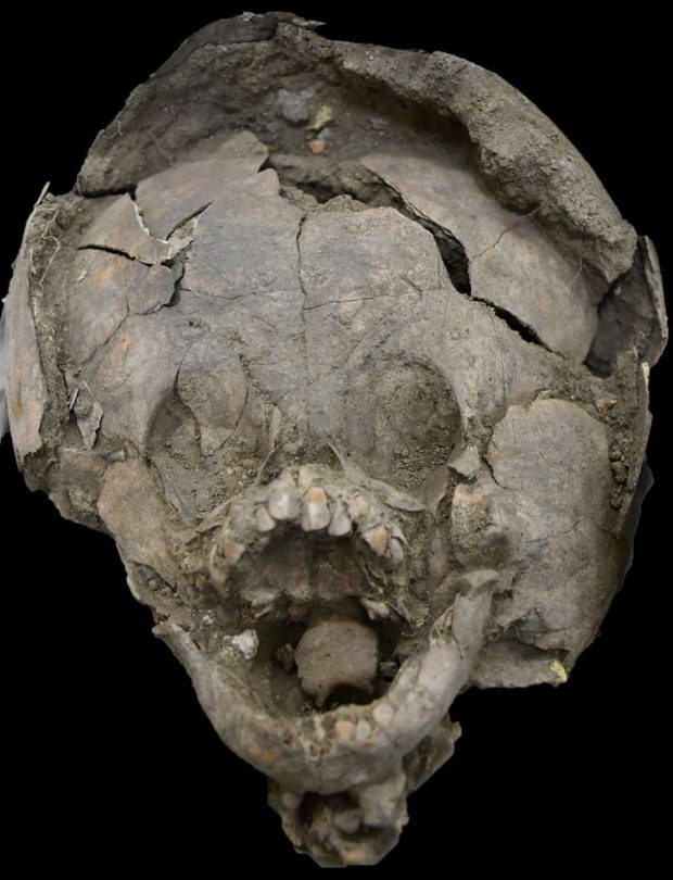 Children's skulls